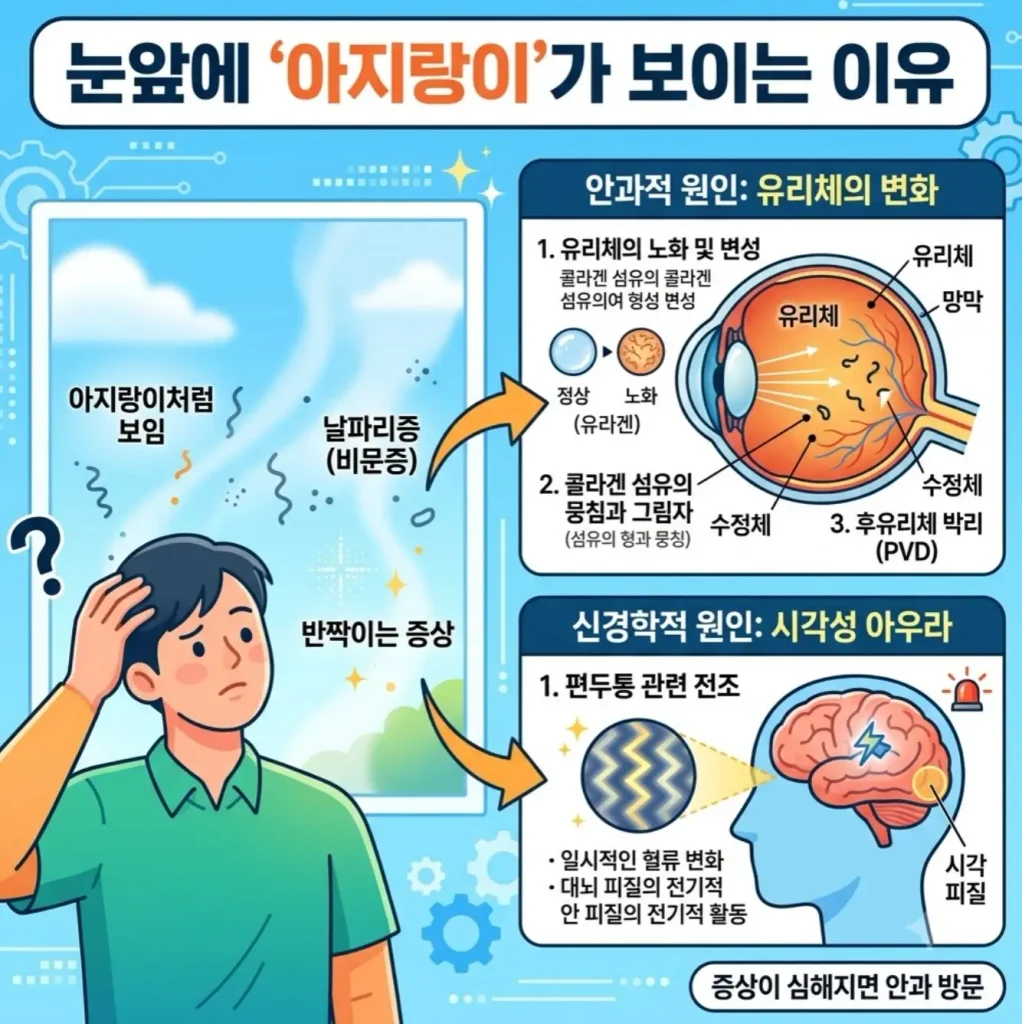 눈앞에-아지랑이-같은-것이-날아다니는-이유